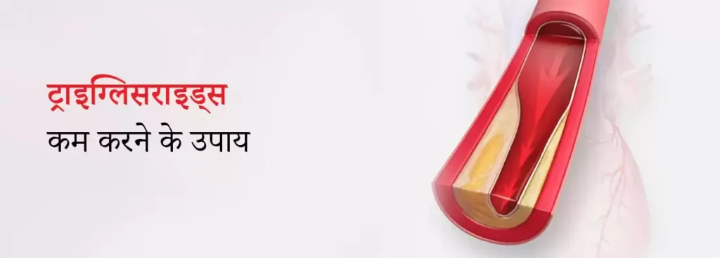 কোলেস্টেরল এবং ট্রাইগ্লিসারাইড Triglycerides কমাতে যে খাবারগুলো খাওয়া উচিত