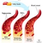 কোলেস্টেরল এবং ট্রাইগোলাইসিস কম করার জন্য কি কি ফুড এবং মেডিসিন খাওয়া দরকার